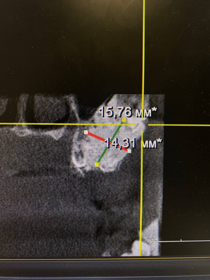 Дикие случаи с КТ со счастливым концом - 16 image