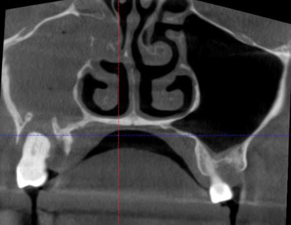 Дикие случаи с КТ со счастливым концом - 17 image