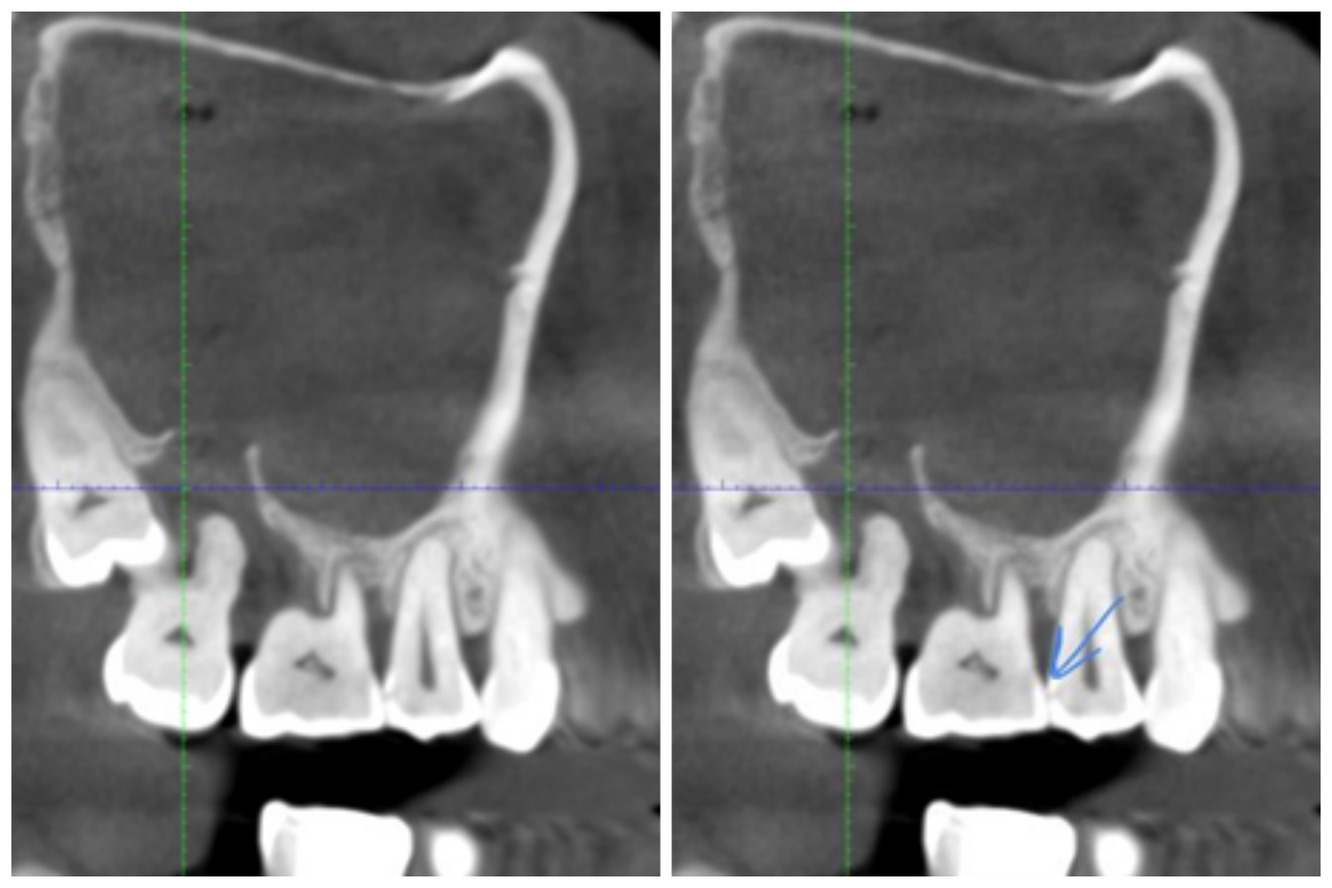 Дикие случаи с КТ со счастливым концом - 18 image