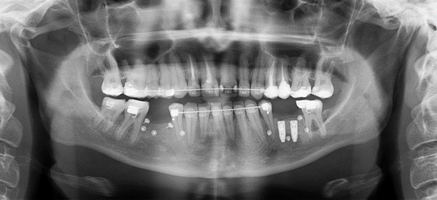 Дикие случаи с КТ со счастливым концом - 19 image