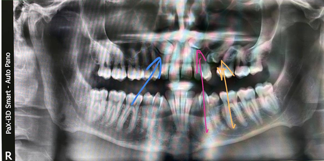Дикие случаи с КТ со счастливым концом - 21 image
