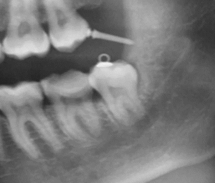 Дикие случаи с КТ со счастливым концом - 7 image