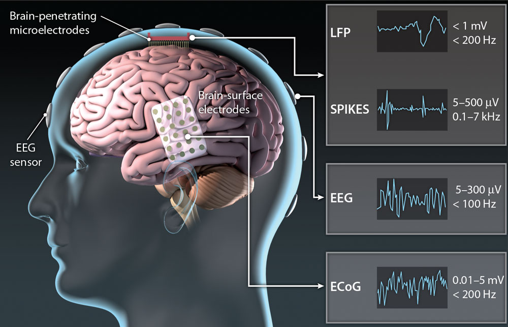 Электрическую активность сенсомоторной коры головного мозга регистрируют по 32 каналам с частотой 586 Гц. Диапазоном полосовой фильтрации стал промежуток между 1 и 300 Гц. Именно в нём скрыты данные, необходимые для иннервации нижних конечностей.