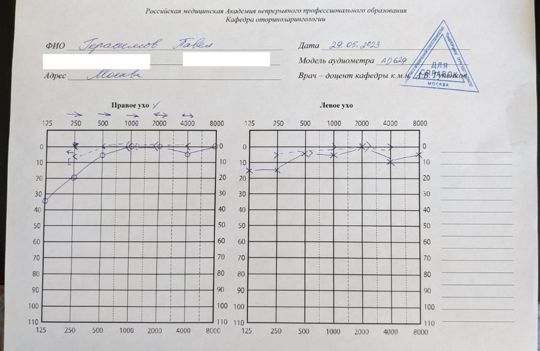 Аудиометрия,05.2023,ПрофЛорЦентр