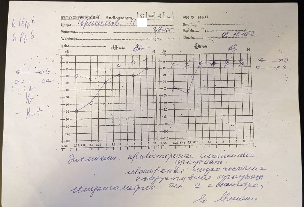 Аудиометрия,11.2022,Семейный_доктор