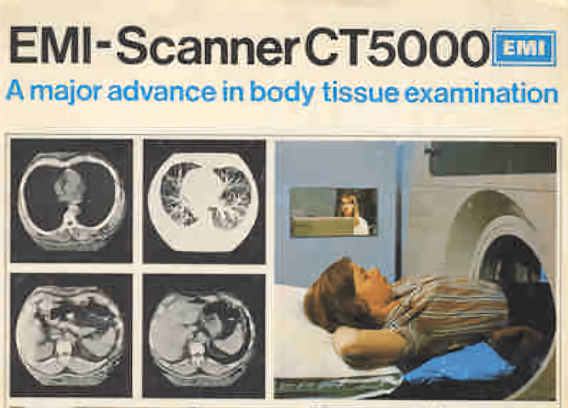 Как инженер звукозаписывающей компании изобрел компьютерный томограф - 12 Как инженер звукозаписывающей компании изобрел компьютерный томограф - 12