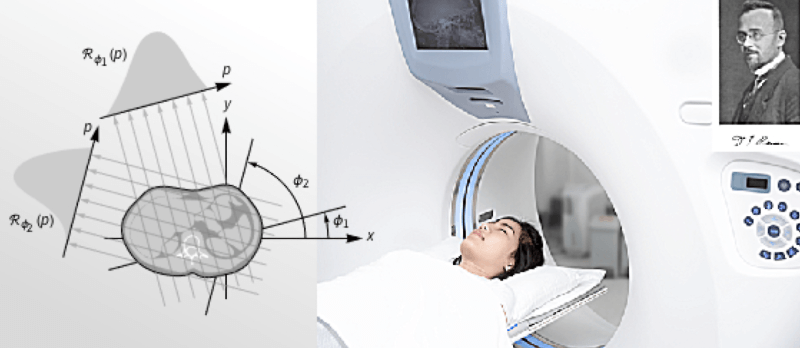 Как инженер звукозаписывающей компании изобрел компьютерный томограф - 3 Как инженер звукозаписывающей компании изобрел компьютерный томограф - 3