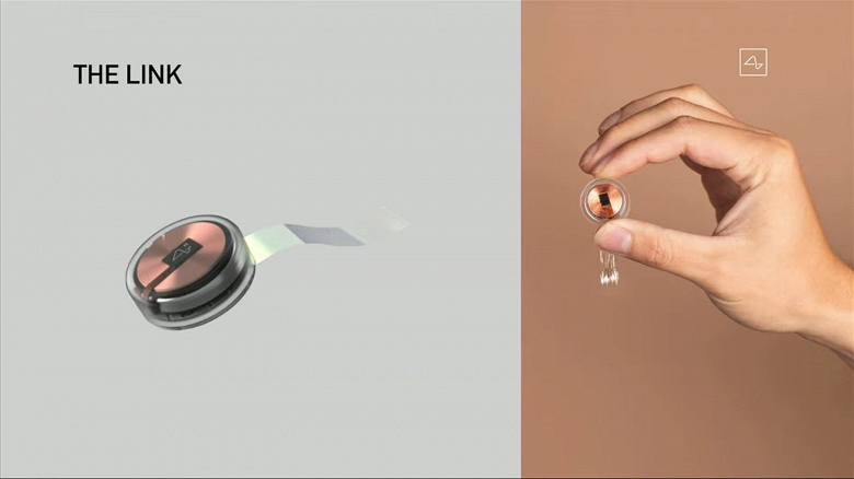 &laquo;Я могу просто думать, куда смотреть. Это безумие&raquo;. Второй парализованный пациент Neuralink уже играет в Counter-Strike 2 силой мысли