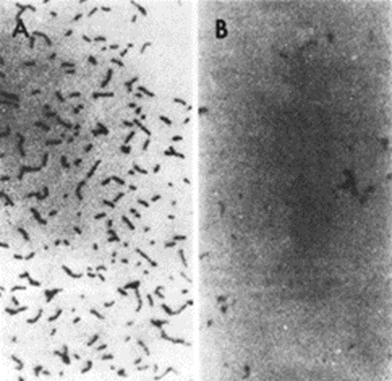 Зубной налёт и старый немец Альцгеймер: разрушаем чувство кворума - 4 image