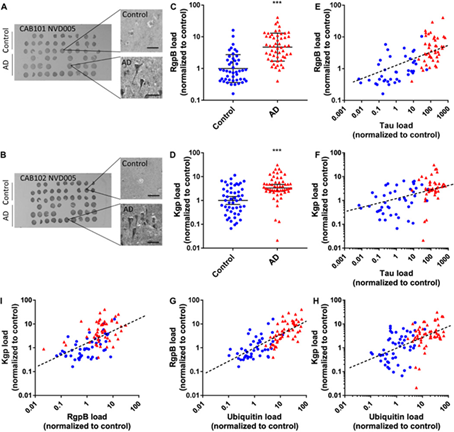 Зубной налёт и старый немец Альцгеймер: разрушаем чувство кворума - 8 image