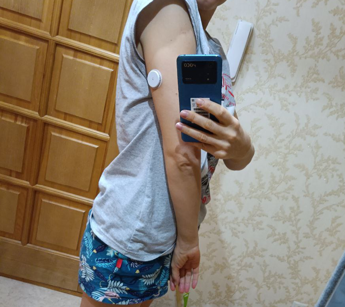 Как выглядит датчик Freestyle libre (1 поколение) на руке