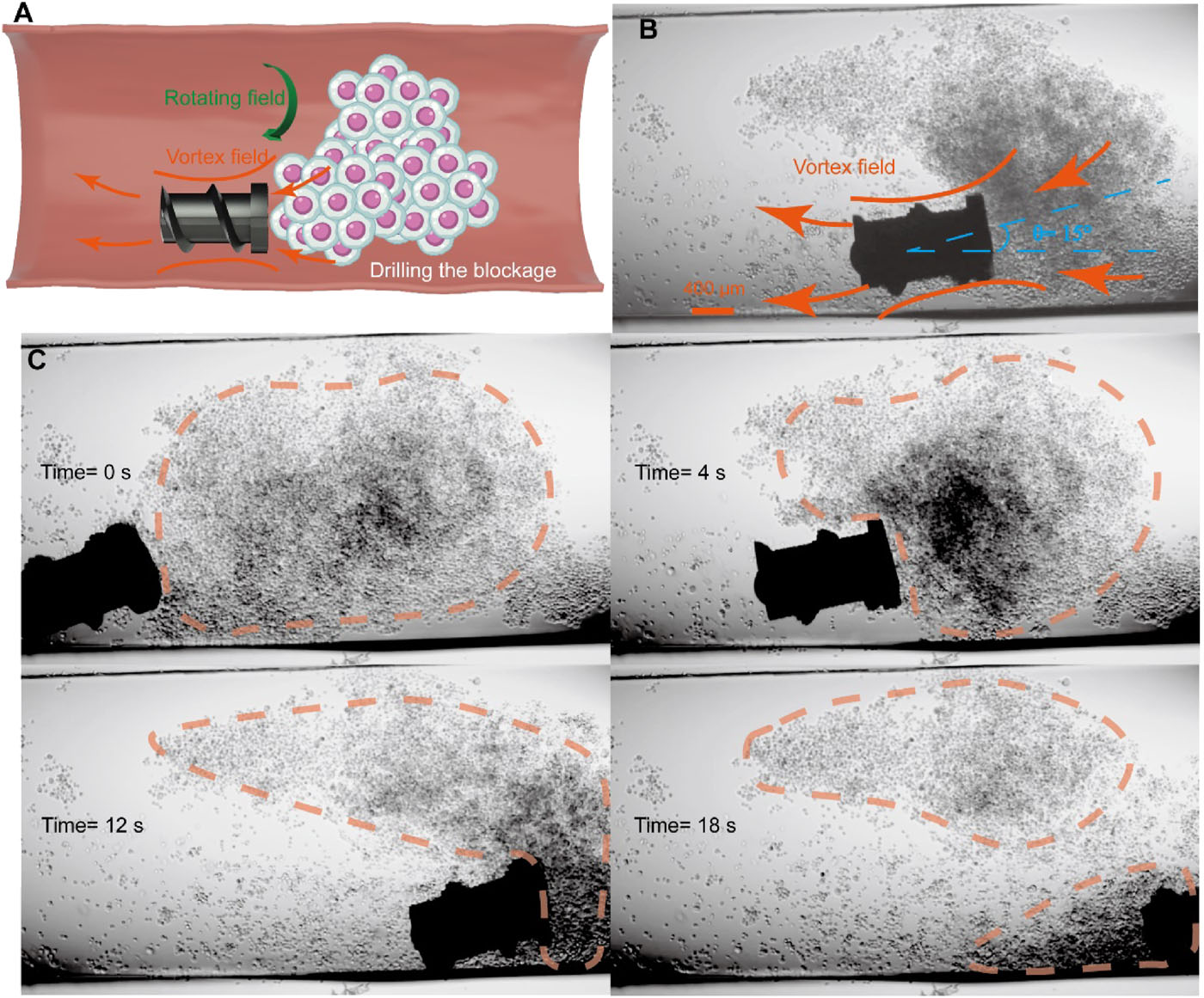 Крошечные роботы для лечения бесплодия - 5 Крошечные роботы для лечения бесплодия - 5