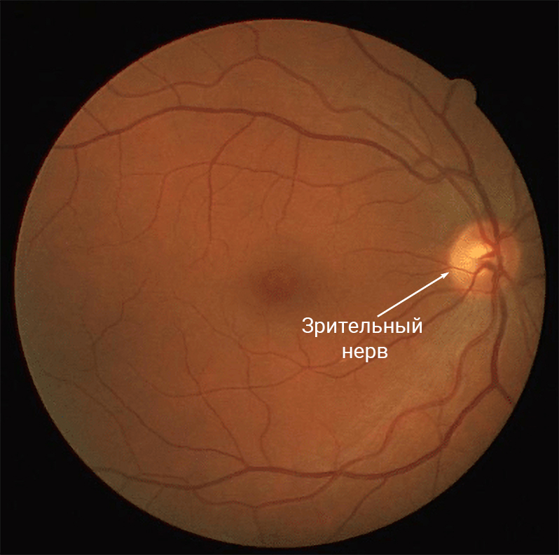 Зрение и нейронные сети — как мы на самом деле видим мир - 5 Зрение и нейронные сети — как мы на самом деле видим мир - 5