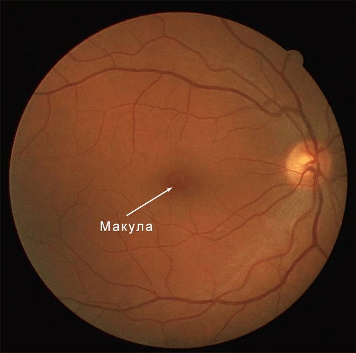 Макулярный регион сетчатки на фотографии глазного дна. Зрение и нейронные сети - как мы на самом деле видим мир Научпоп, Биология, Зрение, Глаза, Нейронные сети, Наука, Сетчатка, Ученые, Исследования, Офтальмология, Длиннопост