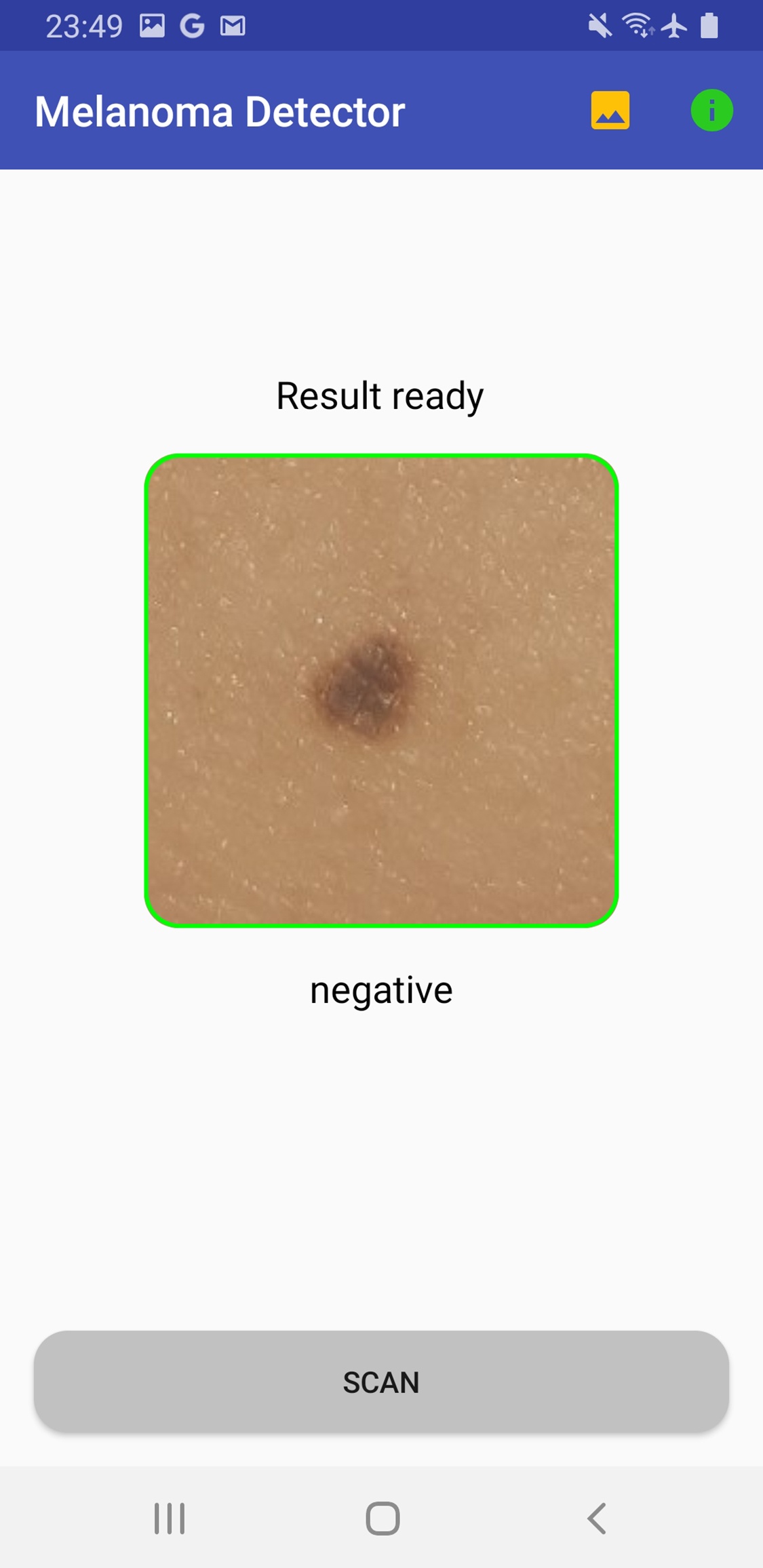 Как я захотел проверить родинку на меланому, а в результате создал бесплатное приложение - 1 Как я захотел проверить родинку на меланому, а в результате создал бесплатное приложение - 1