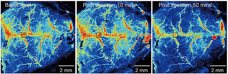 Микропластик достигает мозга млекопитающих за считанные часы