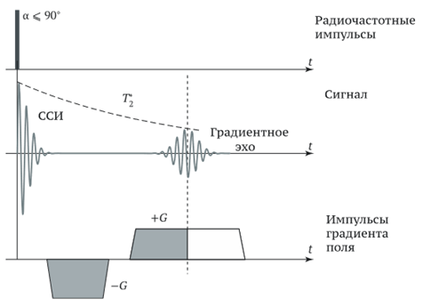 Рисунок 14. Градиентное эхо (Gradient Echo, GE) [2]