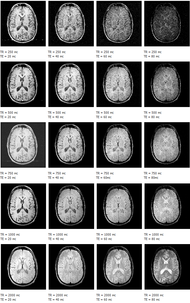 Рисунок 15. Зависимость контраста от параметров TR и TE для ИП класса спиновое эхо [7]