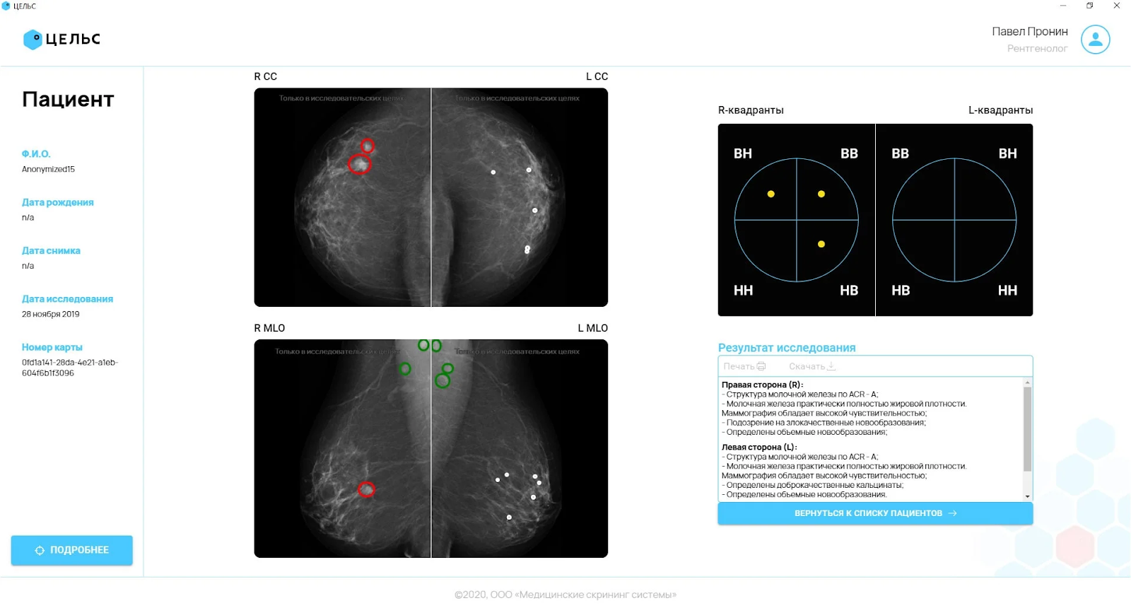 ИИ в медицине: назначает диагнозы и спасает жизни - 2