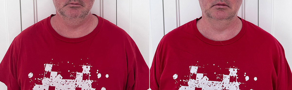 Как я избавляюсь от компьютерной шеи. Часть 2 - 2