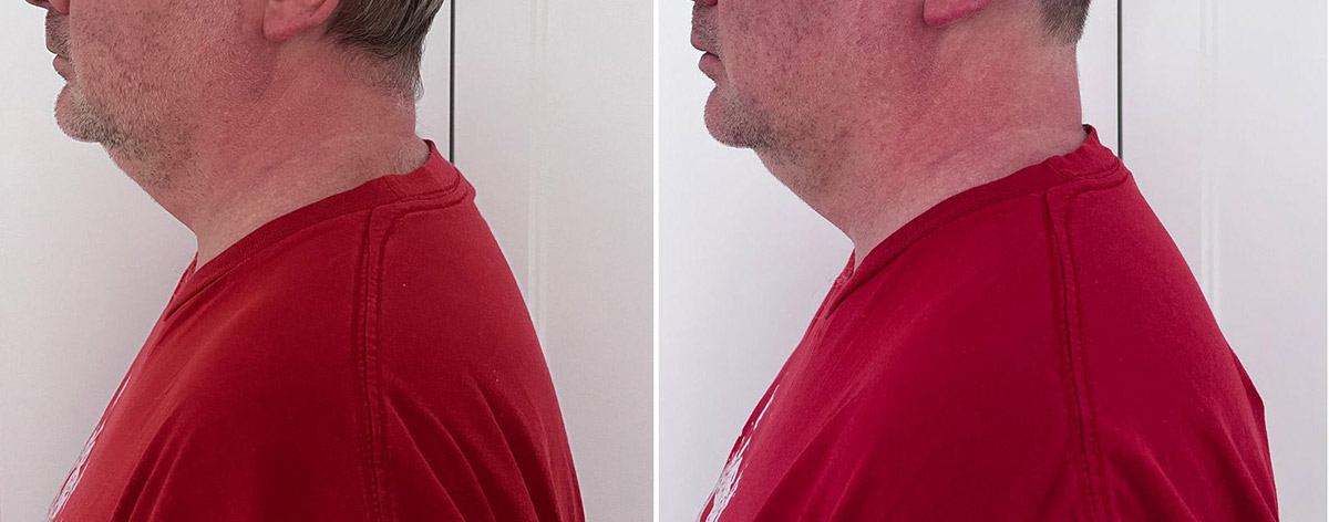 Как я избавляюсь от компьютерной шеи. Часть 2 - 3