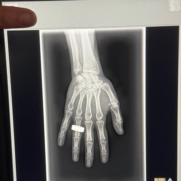 Исторический момент: Опубликован первый рентгеновский снимок из космоса