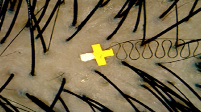 Инженеры из США изобрели микрочип для управления техникой при помощи мысли: крошечный датчик обеспечивает точность до 96,4% и не требует имплантации - 1 Инженеры из США изобрели микрочип для управления техникой при помощи мысли: крошечный датчик обеспечивает точность до 96,4% и не требует имплантации