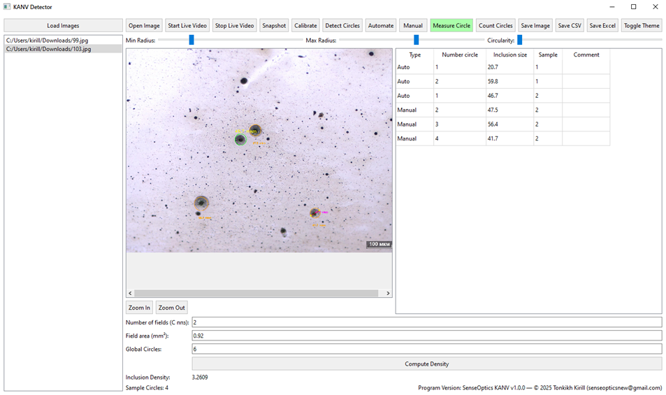 Пример металлографического изображения после травления (конструкционная низколегированная сталь, ×100) с автоматически выявленными КАНВ, помеченными цветными контурами.