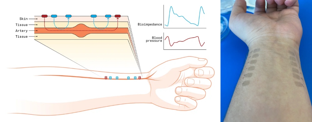 Суть метода. Красным обозначены излучающие электроды, синим — приемные. Графеновые татуировки помогают контролировать основные параметры сердечно-сосудистой системы человека