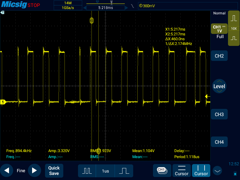 Ширина двух импульсов схлопнулась почти в 0, потому что сработали прерывания