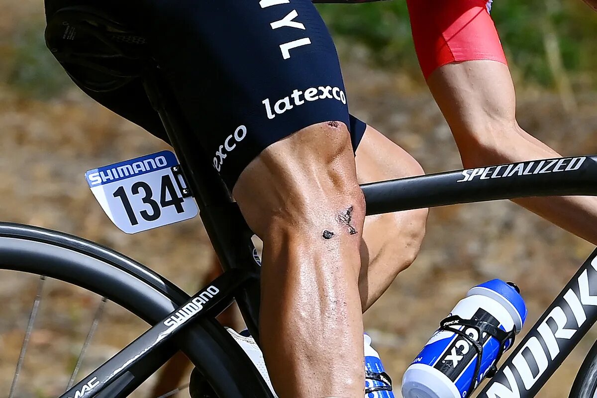 Сильная боль в колене при езде на велосипеде вызвана напряженностью или слабостью окружающих мышц - Тим де Ваэле