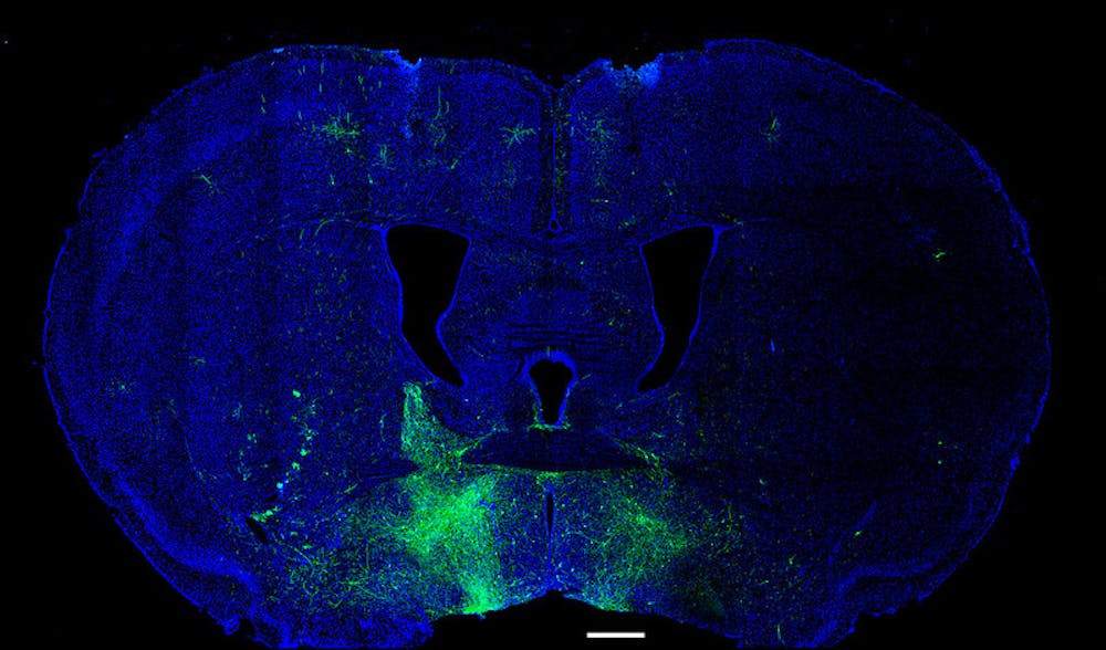  Изменения связей в миндалине, окрашенные в зелёный цвет, связаны с депрессией. 