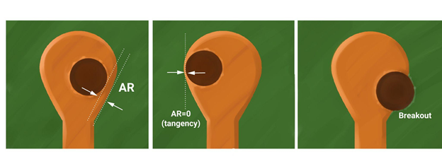 Примеры неразрывности и разрывности гарантийного пояска. AR — annular ring.