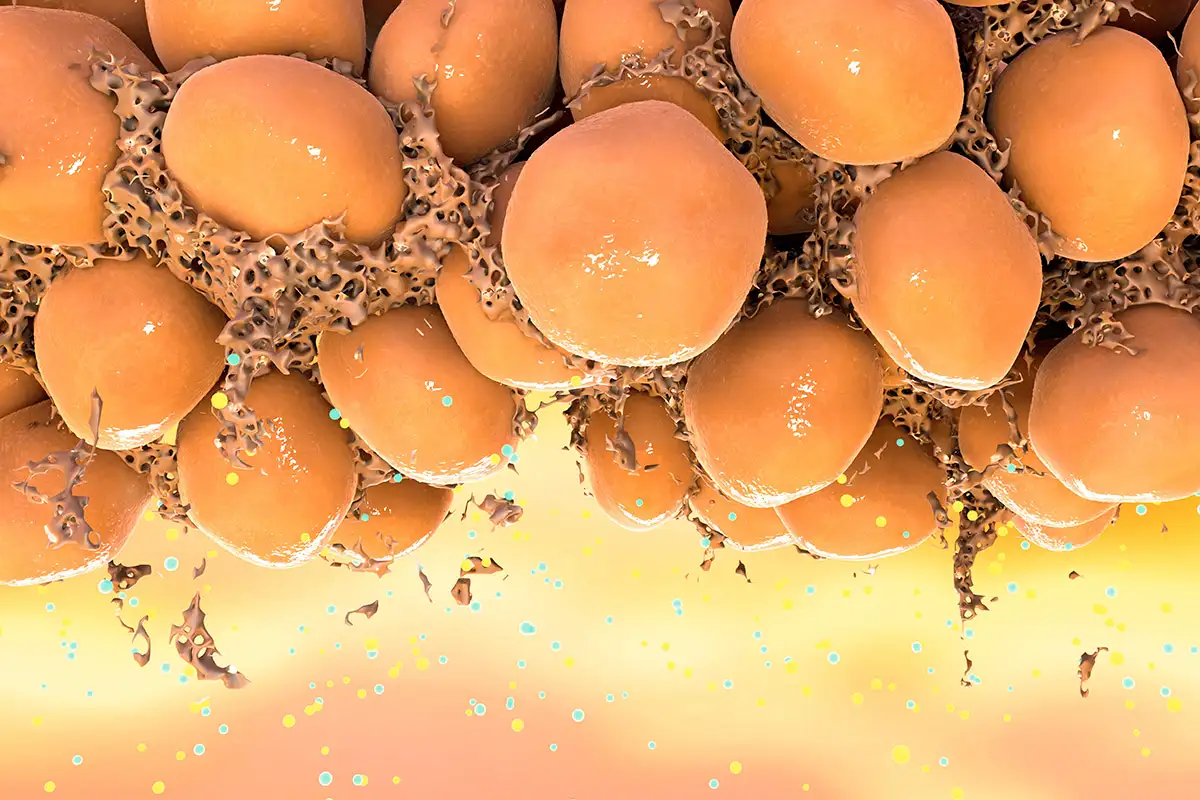 Ожирение: сказ о том, как жир твой иммунитет шатал, а ещё мозг и детей - 5