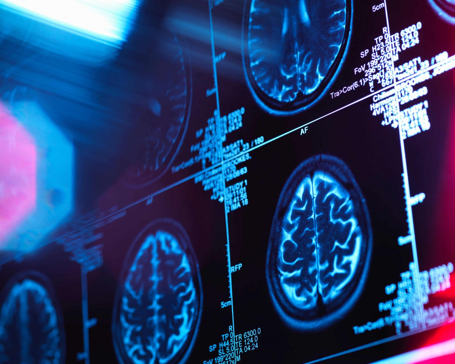  Препарат действует, имитируя гормон GLP-1, который выделяется в кишечнике во время еды и воздействует на рецепторы по всему телу, включая мозг.