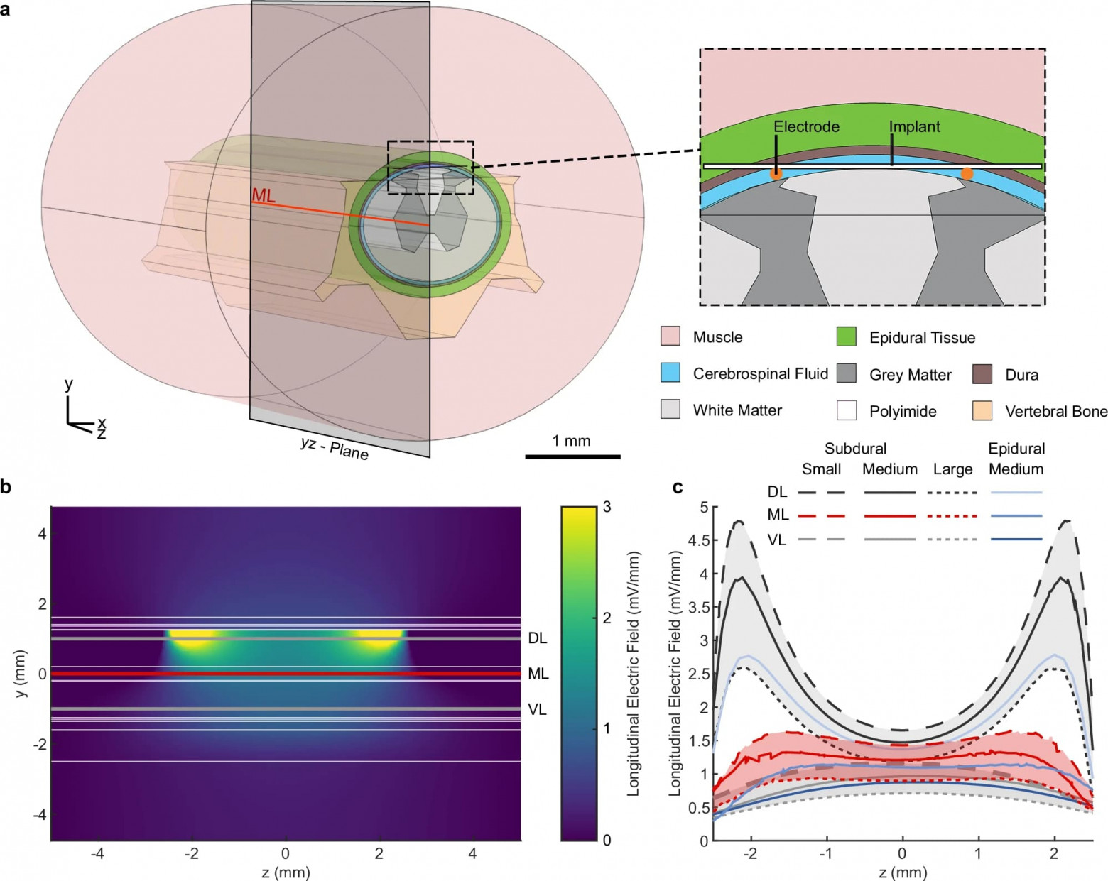 Стимуляция восстановления спинного мозга - 5