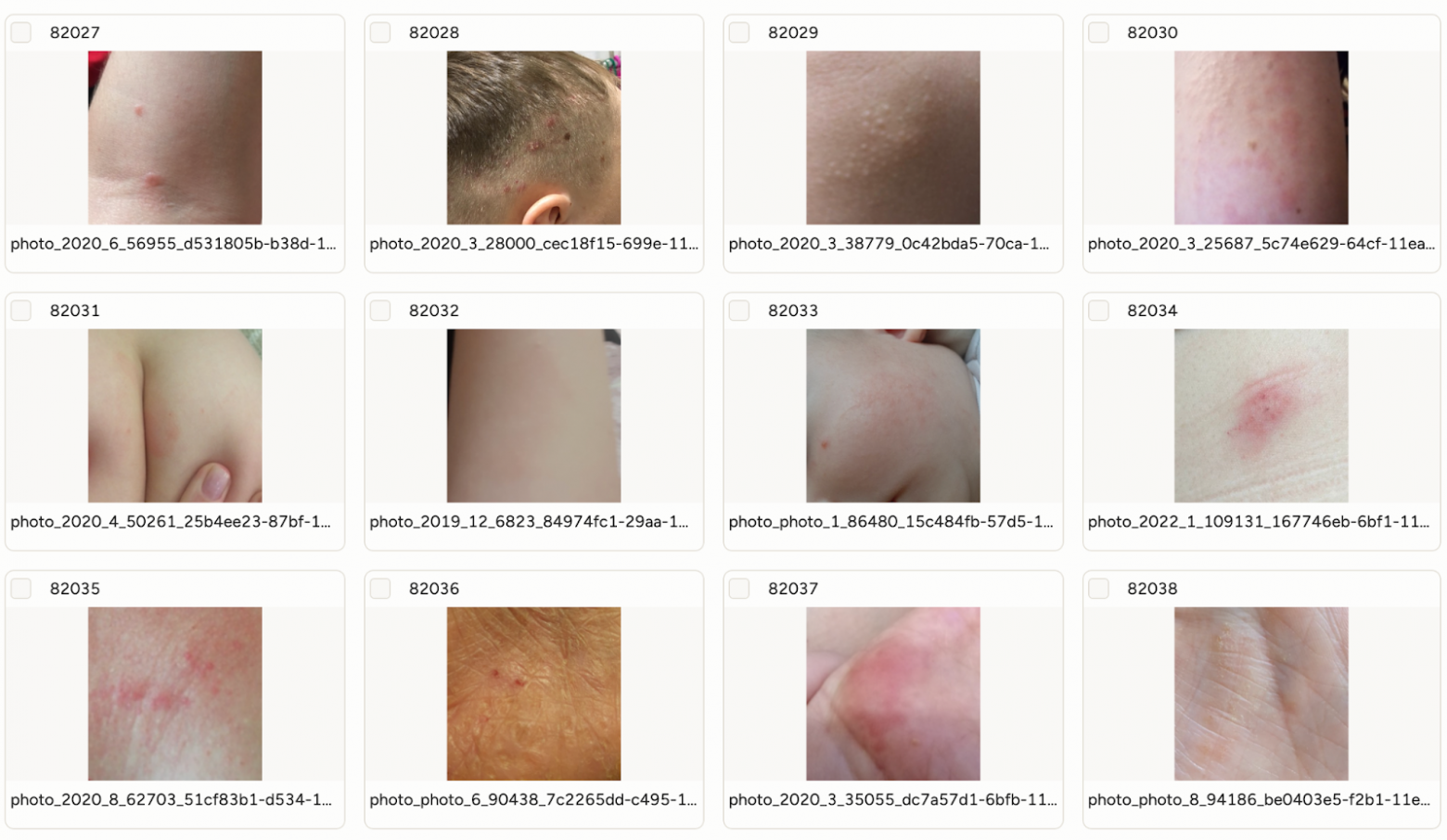 Скриншот части датасета Scanderm: он содержит изображения кожных патологий для задач детекции и классификации  