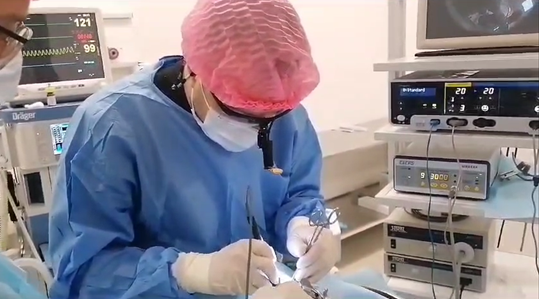 Провожу тонзиллэктомию (удаление небных миндалин)