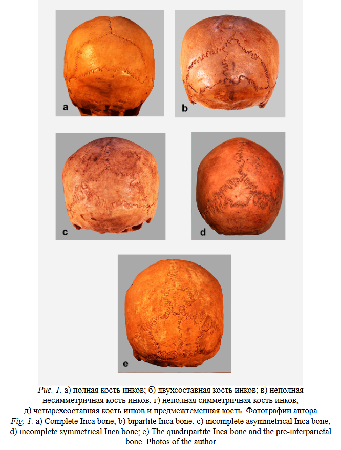 Пример прямой эволюции человека — кость инков - 1 Пример прямой эволюции человека — кость инков - 1