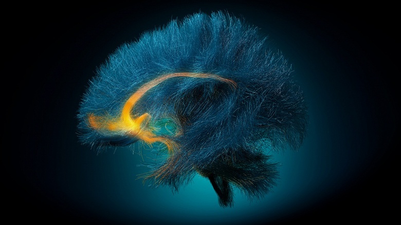 Имплант в мозге предупредил о депрессии за пять недель до рецидива &mdash; теперь врачи хотят реагировать заранее