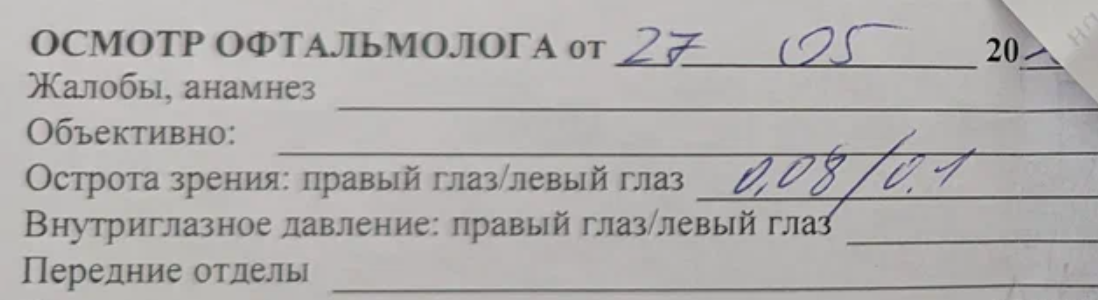 Острота зрения Острота зрения