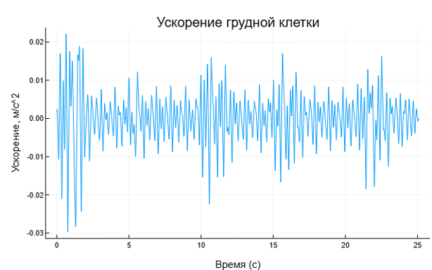 Бесконтактная ЭКГ: биорадиолокация и ИИ в действии - 19 Бесконтактная ЭКГ: биорадиолокация и ИИ в действии - 19
