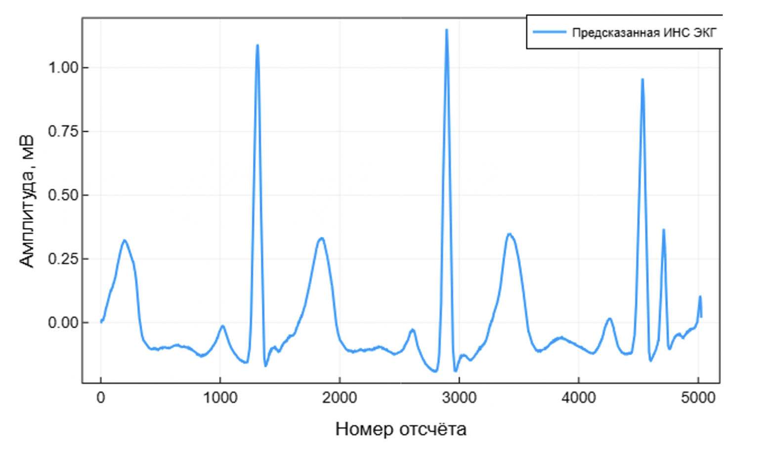 Бесконтактная ЭКГ: биорадиолокация и ИИ в действии - 26 Бесконтактная ЭКГ: биорадиолокация и ИИ в действии - 26