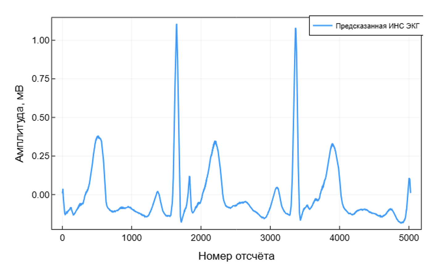 Бесконтактная ЭКГ: биорадиолокация и ИИ в действии - 27 Бесконтактная ЭКГ: биорадиолокация и ИИ в действии - 27