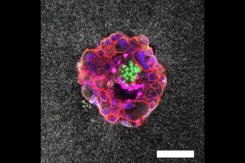 Учёные впервые засняли имплантацию человеческого эмбриона
