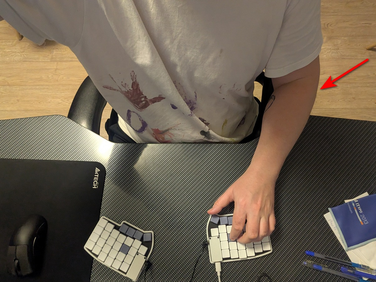 Провисающие локти