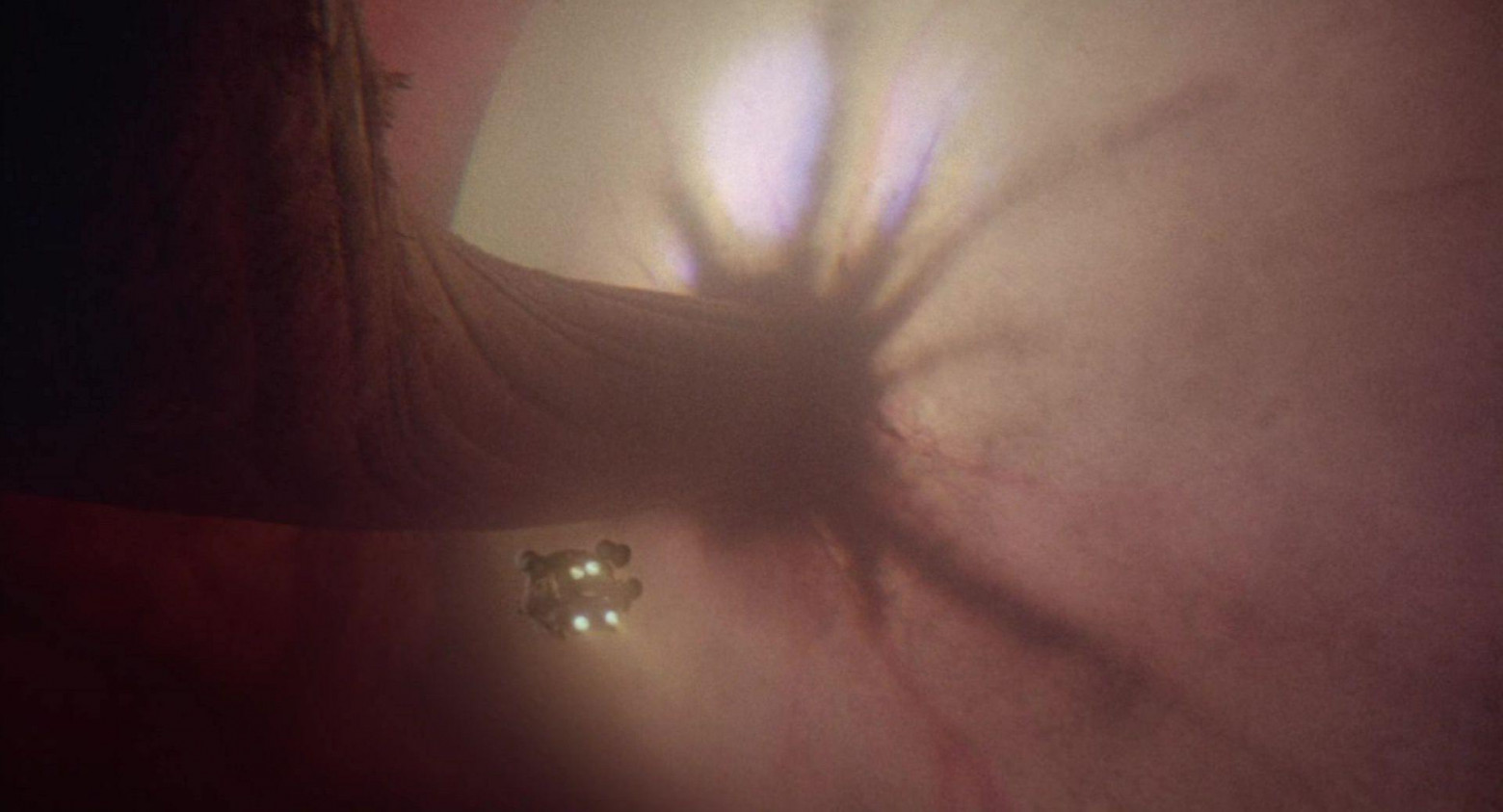 Марк Цукерберг подключается к глазному нерву добровольца, которому заплатил 10 миллионов долларов, чтобы получать обучающие данные прямо с сетчатки.  