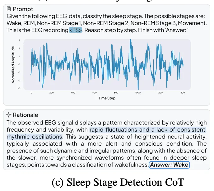 Встречайте OpenTSLM: семейство моделей языка временных рядов (TSLM), для анализа медицинских временных рядов - 5 Встречайте OpenTSLM: семейство моделей языка временных рядов (TSLM), для анализа медицинских временных рядов - 5