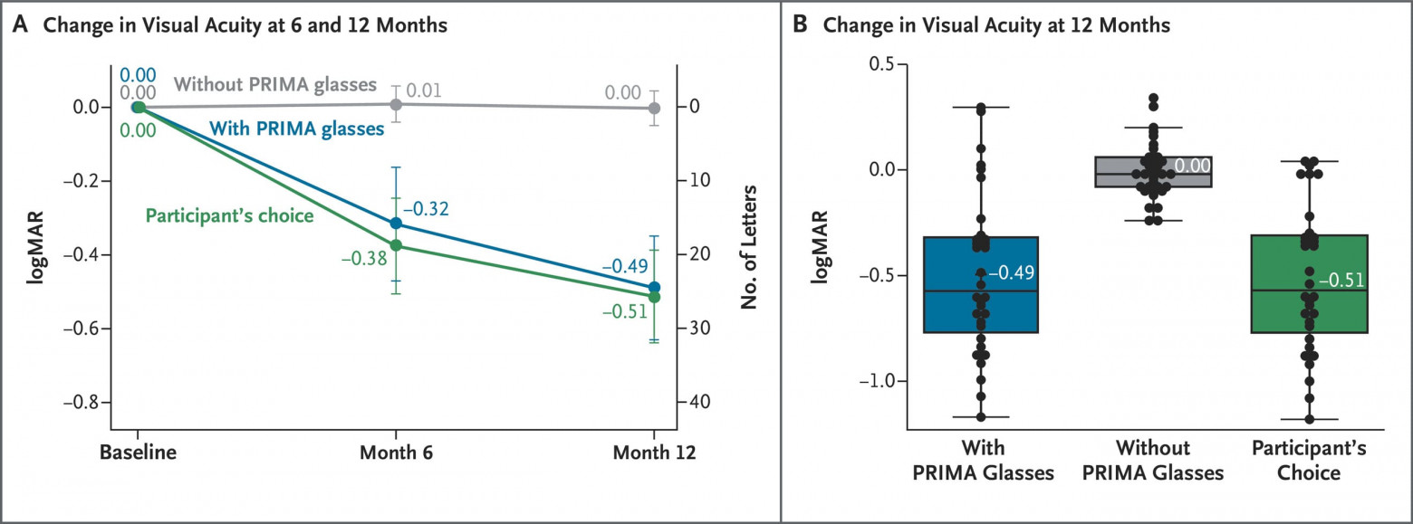 Видеть вновь: ИИ, глазной имплантат и очки дополненной реальности - 5 Видеть вновь: ИИ, глазной имплантат и очки дополненной реальности - 5