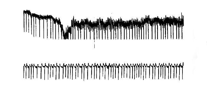Сигнал до фильтрации и после